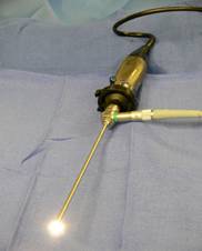 Endoscope - UCLA Pituitary Tumor Program
